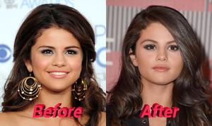 selena gomez previous to and after nose job