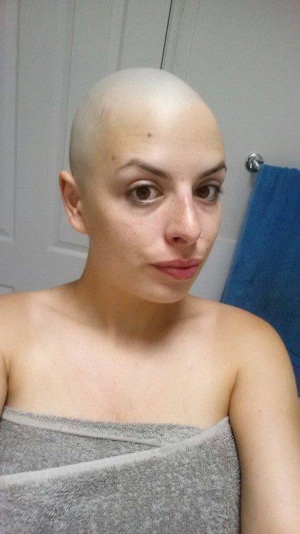 Smooth Bald Head Woman